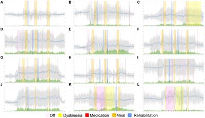 A proof of concept: digital diary using 24-hour monitoring using wearable device for patients with Parkinson’s disease in nursing homes